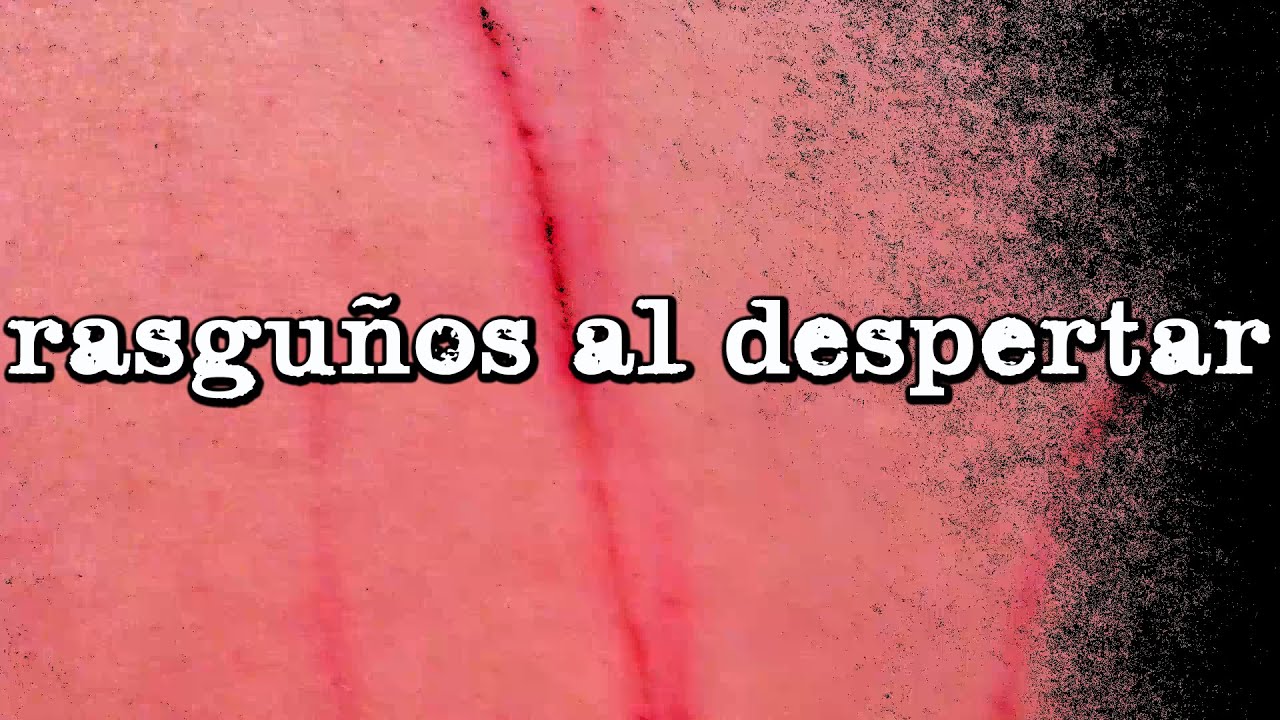 arañazos en el cuerpo al despertar