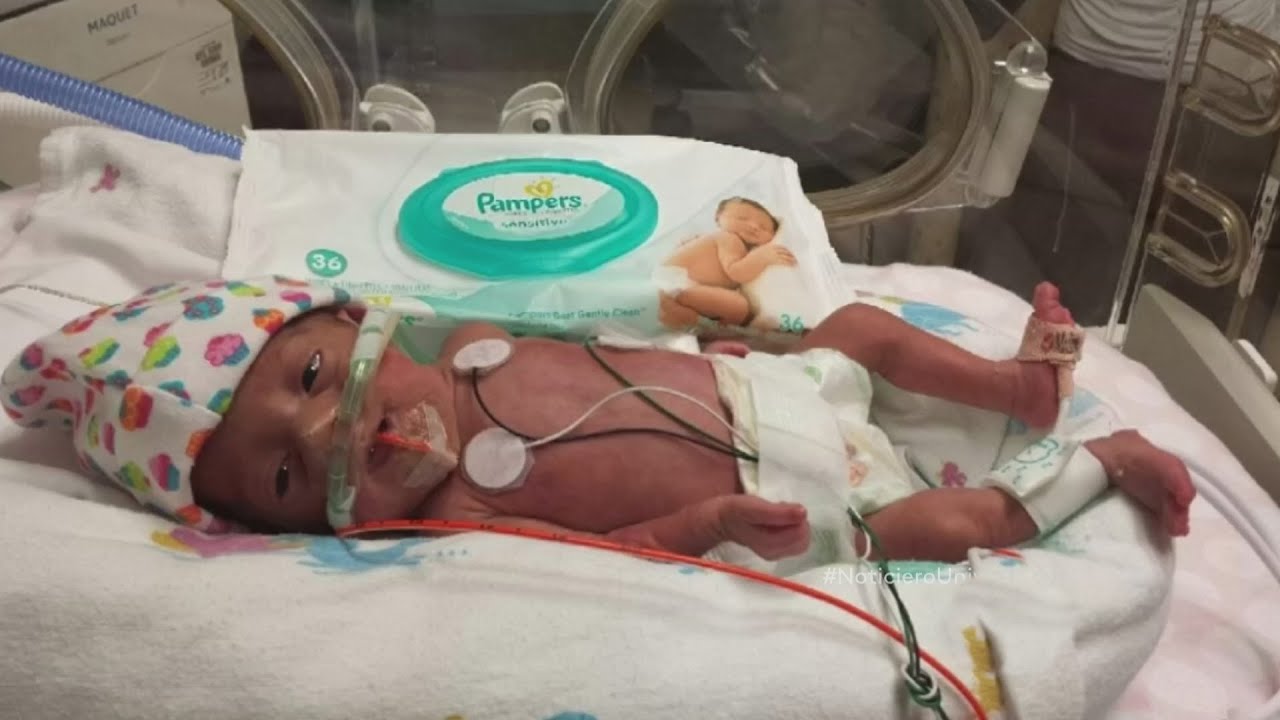 bebes de 7 meses de gestacion nacidos