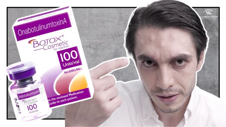 cuantas unidades de botox se deben aplicar
