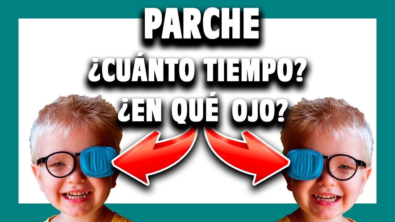 cuanto tiempo lleva parche ojo vago
