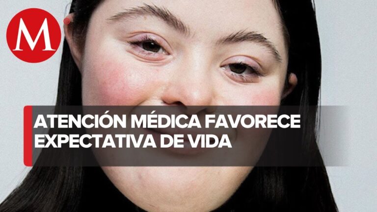 cuanto vive una persona con sindrome de down