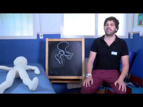 displasia de cadera en bebes tratamiento fisioterapeutico
