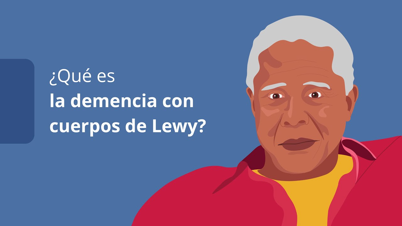 etapas de la demencia por cuerpos de lewy