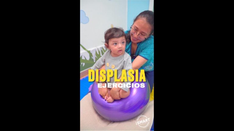 fisioterapia para displasia de cadera en bebes