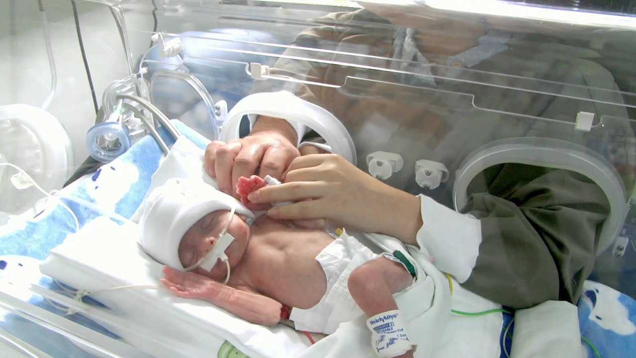 fotos de bebés prematuros de 28 semanas