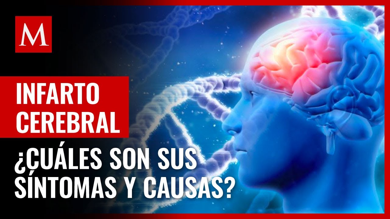 ictus cerebral que afecta a la vista