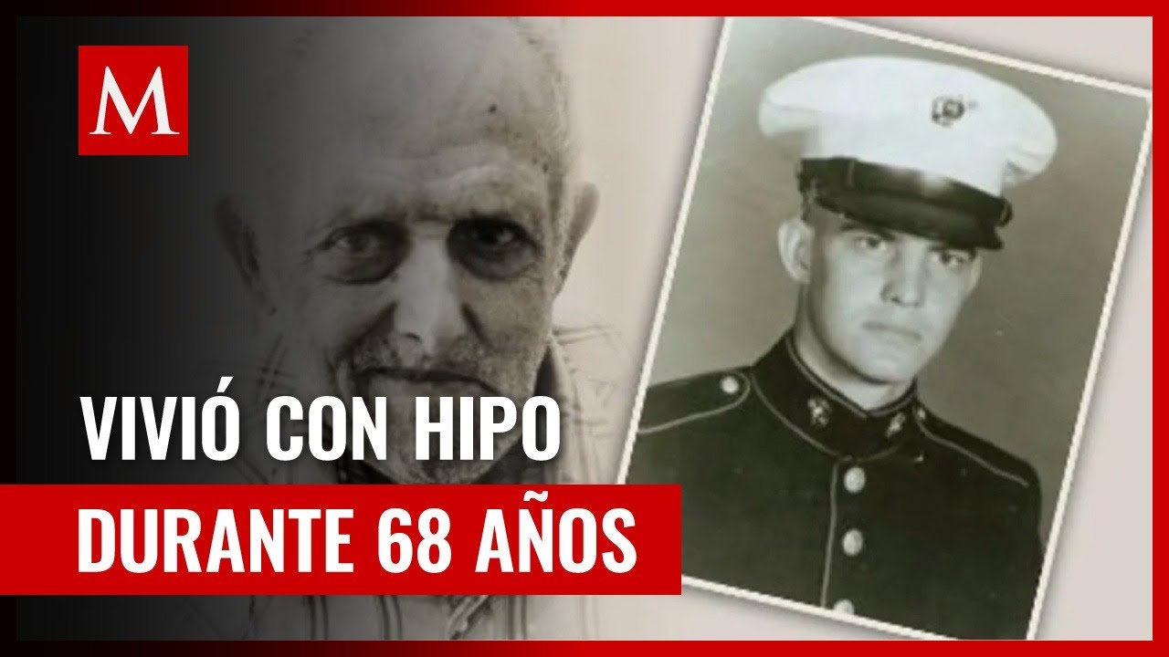 la persona con el hipo mas largo del mundo