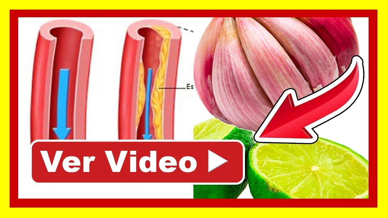 limpiar las arterias con ajo y limon