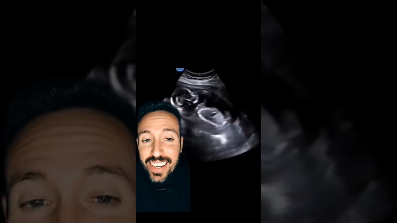 mi bebe no se rie