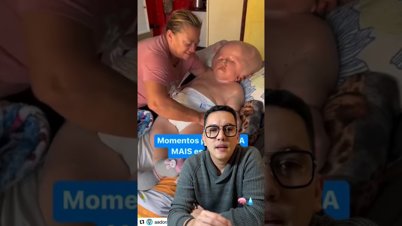 niños con hidrocefalia en la escuela