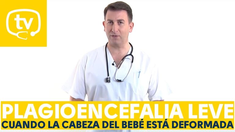 plagiocefalia en niño de 2 años