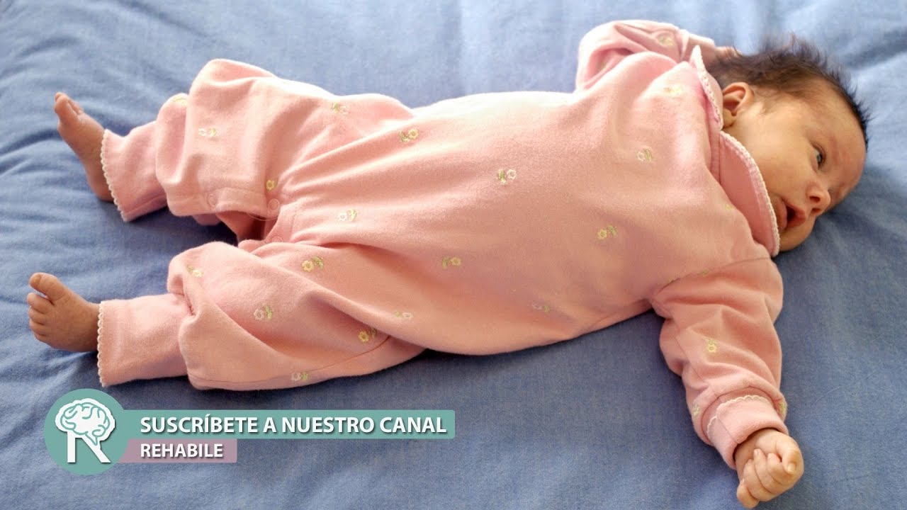 porque mi bebé tuerce la cabeza hacia un lado