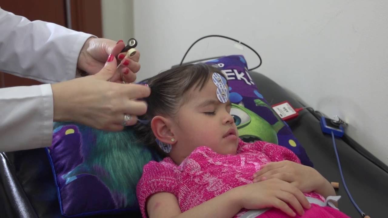 potenciales evocados auditivos niño 2 años