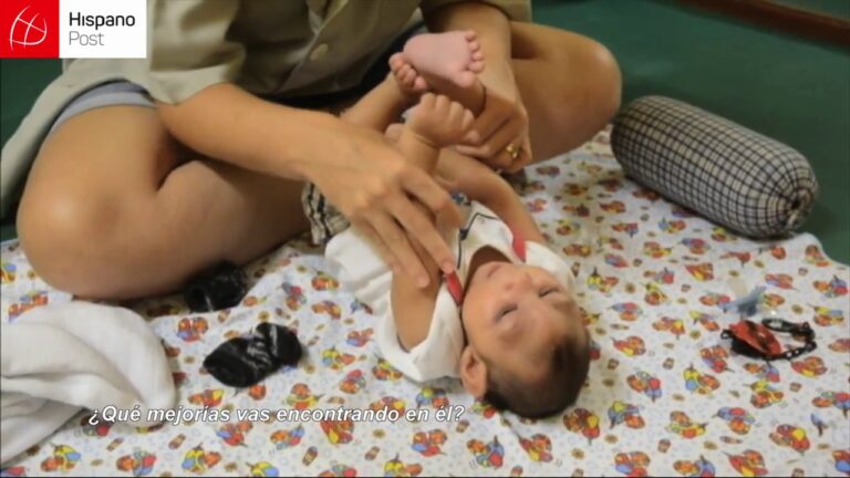 terapia fisica para niños con microcefalia