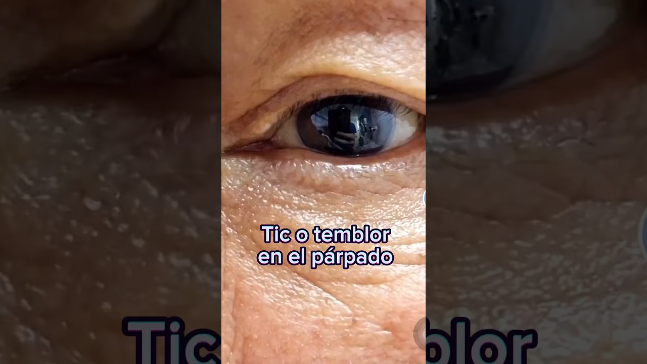 tic constante en el ojo izquierdo